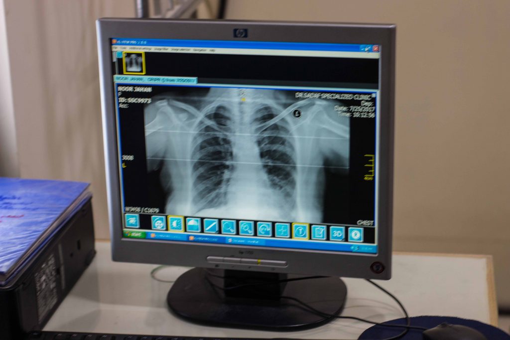 Digital X Ray – Dr Sadaf Specialized Hospital